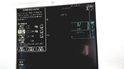 Volcano s5 Imaging System Operator's Manual