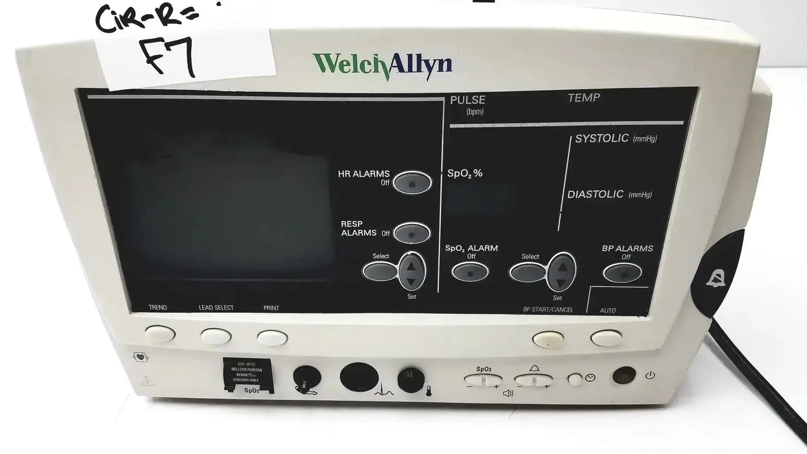 White welch allyn vital signs patient monitor with black display screen showing medical readings and control buttons